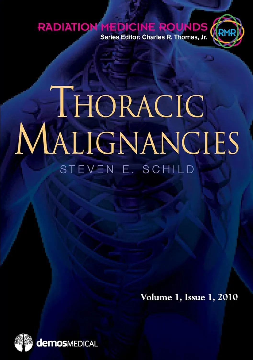 Thoracic Malignancies | Volume 1 | Hardcover