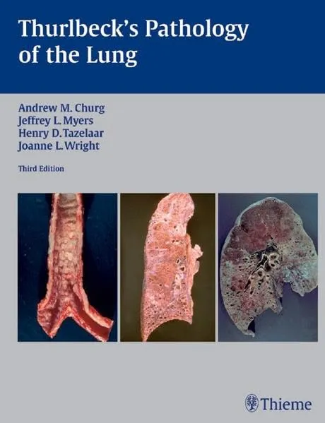Thurbeck's Pathology of the Lung | Third Edition | Hardcover
