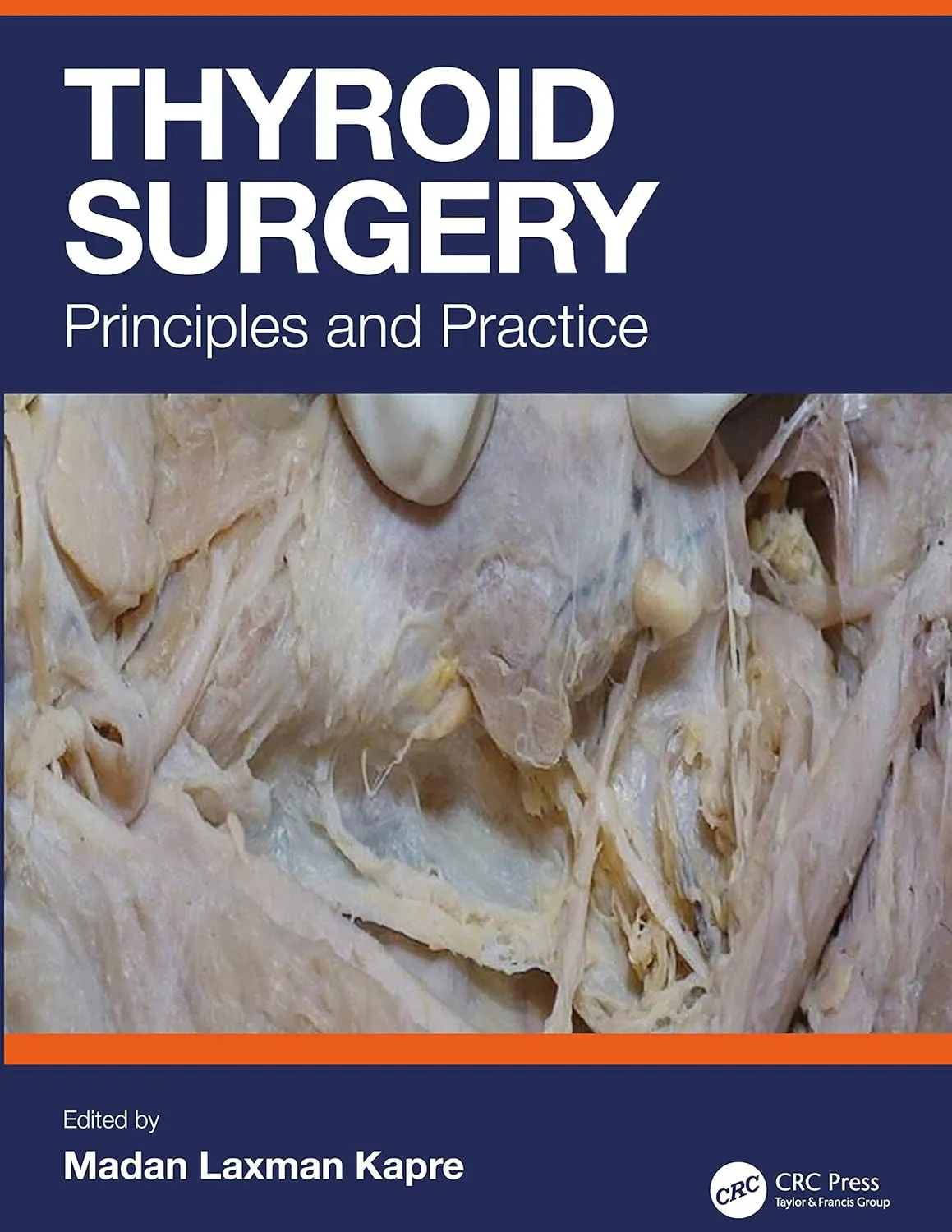 Thyroid Surgery Principles And Practice | Hardcover