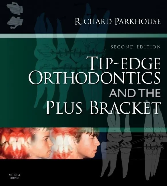 Tip-Edge Orthodontics and the Plus Bracket | 2nd Edition | Hardcover