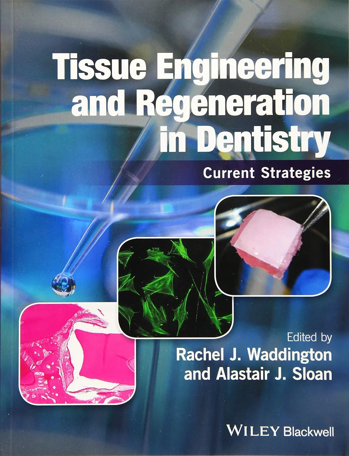 Tissue Engineering and Regeneration in Dentistry | Paperback
