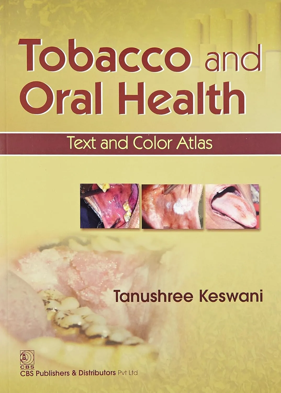 Tobacco and Oral Health Text and Color Atlas | Paperback