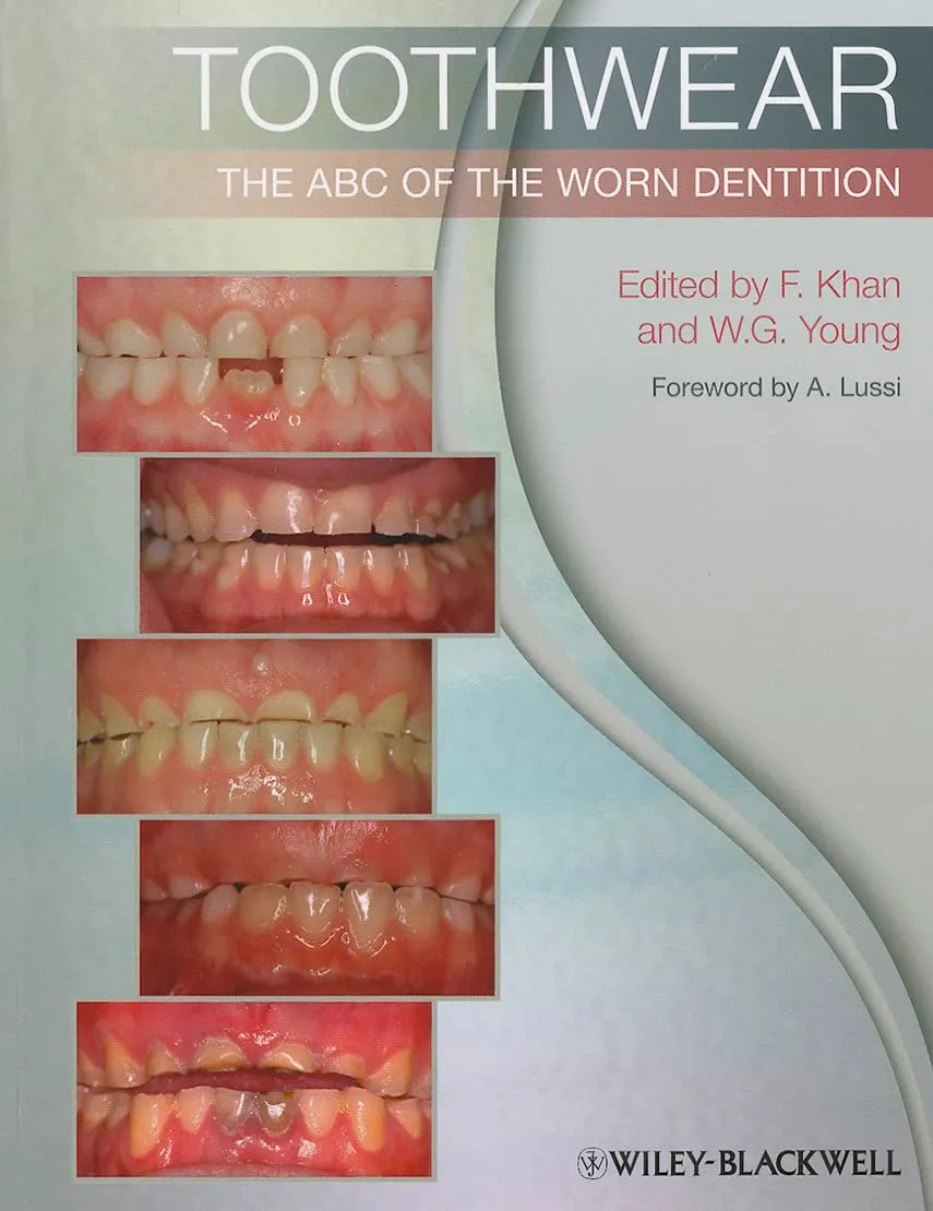 Toothwear The ABC of the Worn Dentition | Paperback