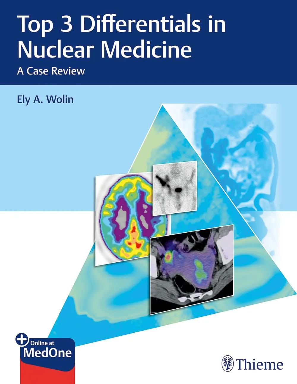 Top 3 Differentials in Nuclear Medicine A Case Review | Paperback