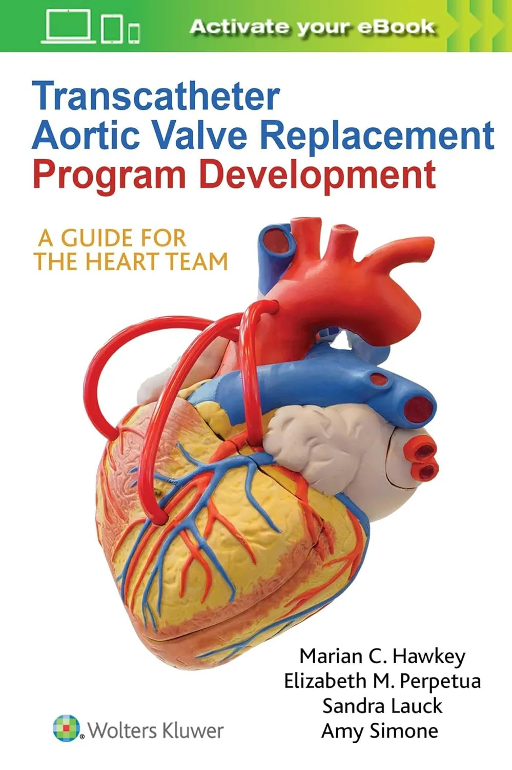 Transcatheter Aortic Valve Replacement Program Development A Guide for the Heart Team | Paperback