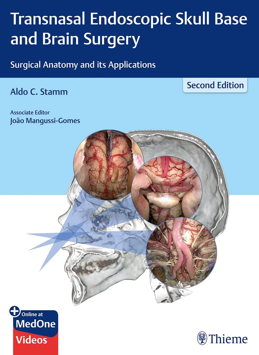 Transnasal Endoscopic Skull Base and Brain Surgery Surgical Anatomy and its Applications | 2nd Edition | Hardcover