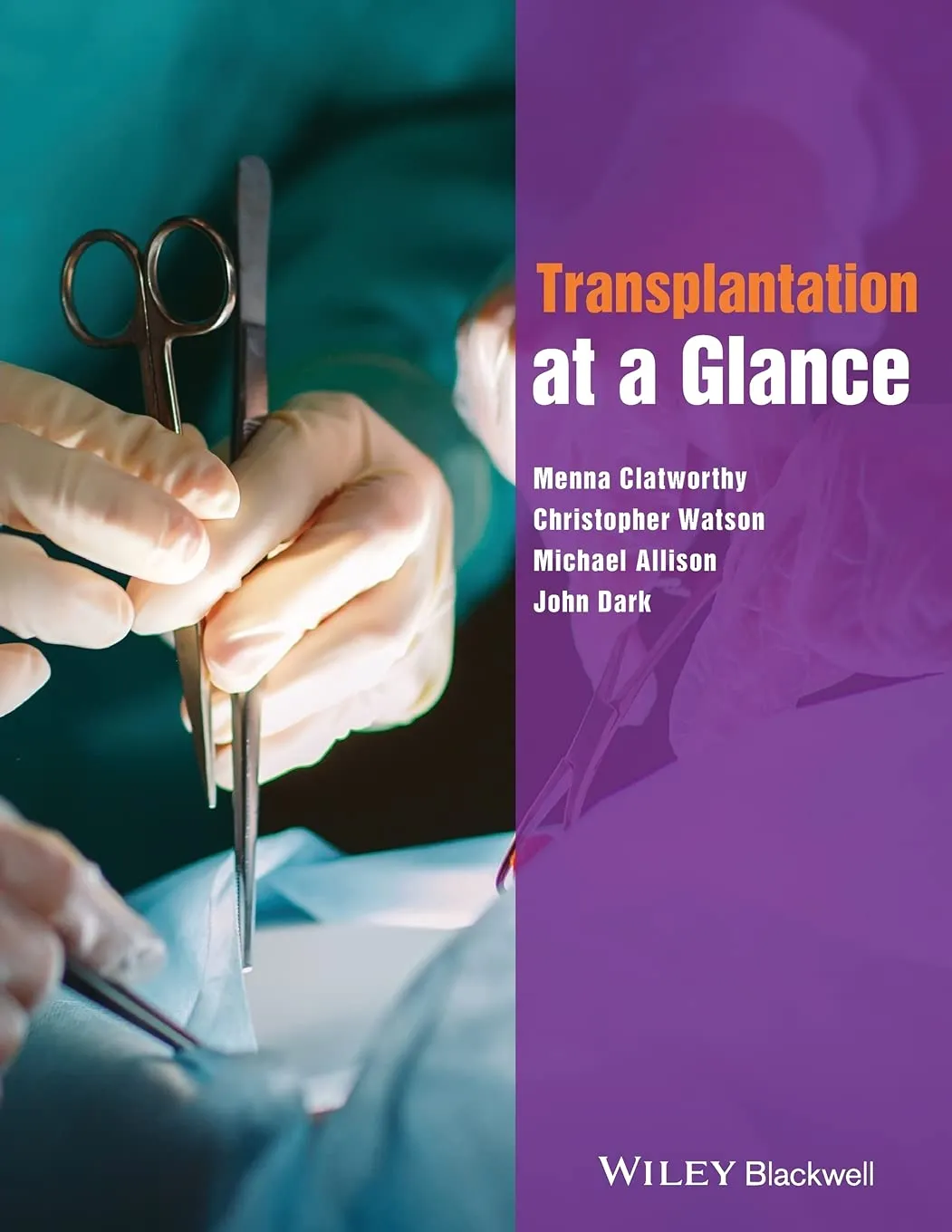 Transplantation at a Glance | Paperback
