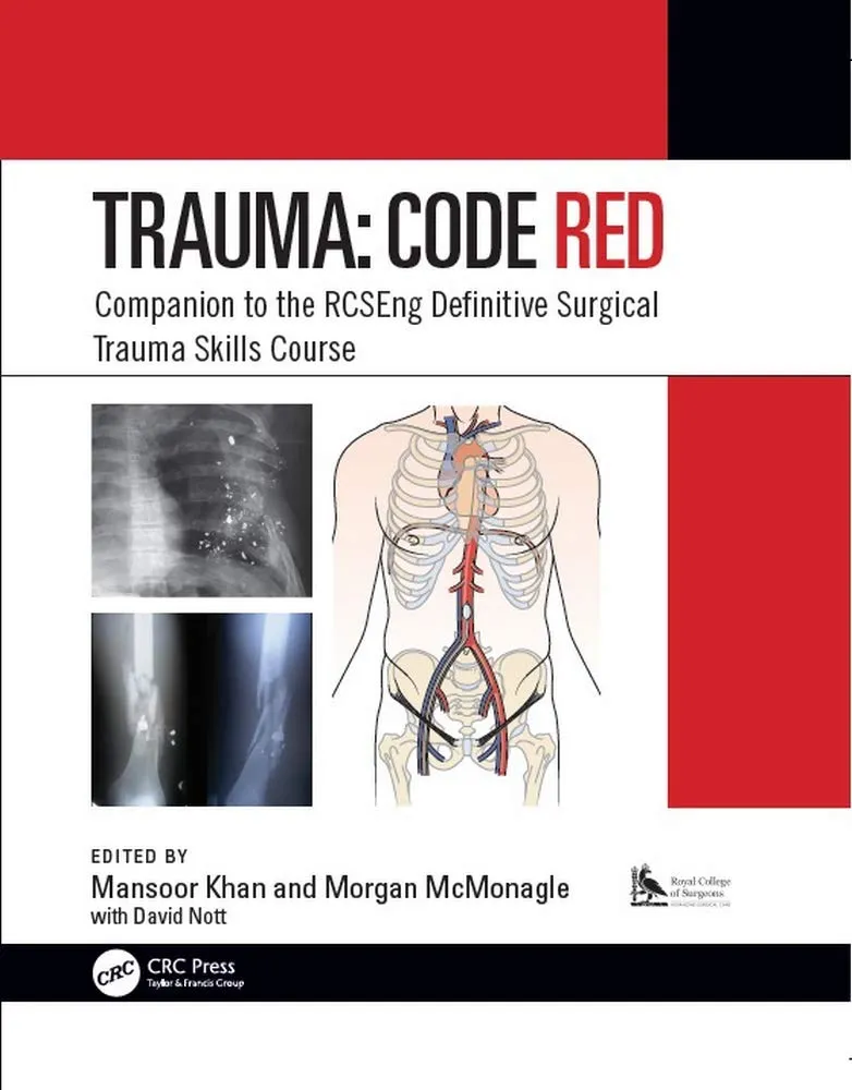 Trauma Code RED Companion to the RCSEng Definitive Surgical Trauma Skills Course | Paperback(Spl. Reprint) (Original Price £79.95)