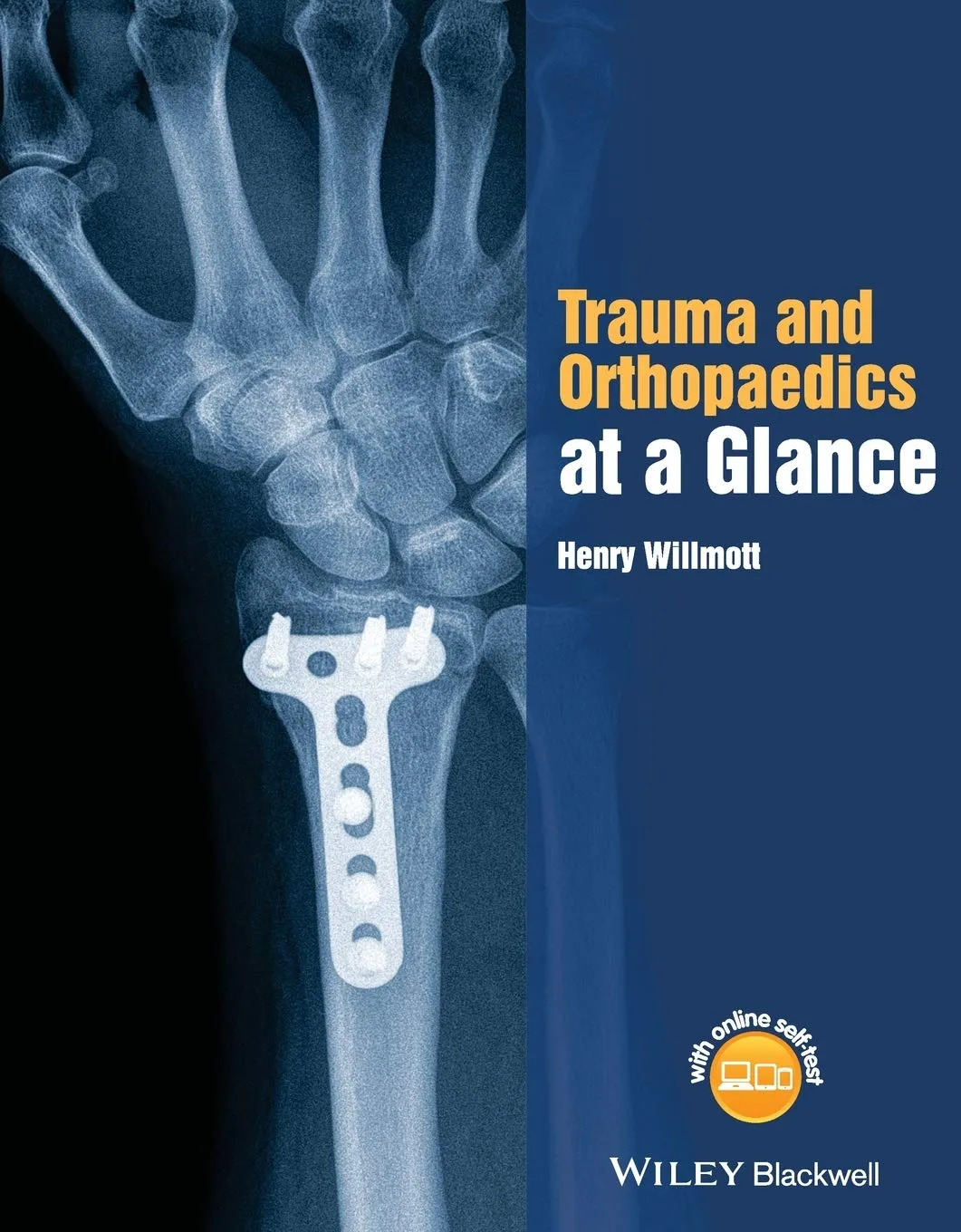 Trauma and Orthopaedics At A Glance | Paperback