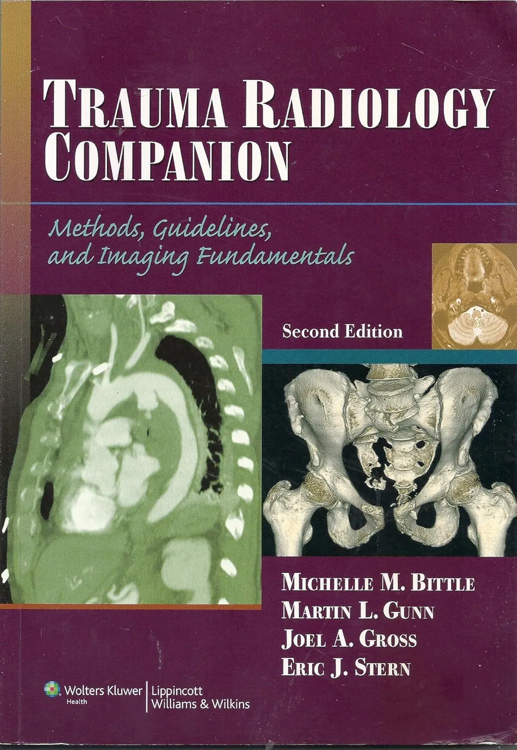 Trauma Radiology Companion 2nd Edition Methods | Guidelines and Imaging Fundamentals | Paperback