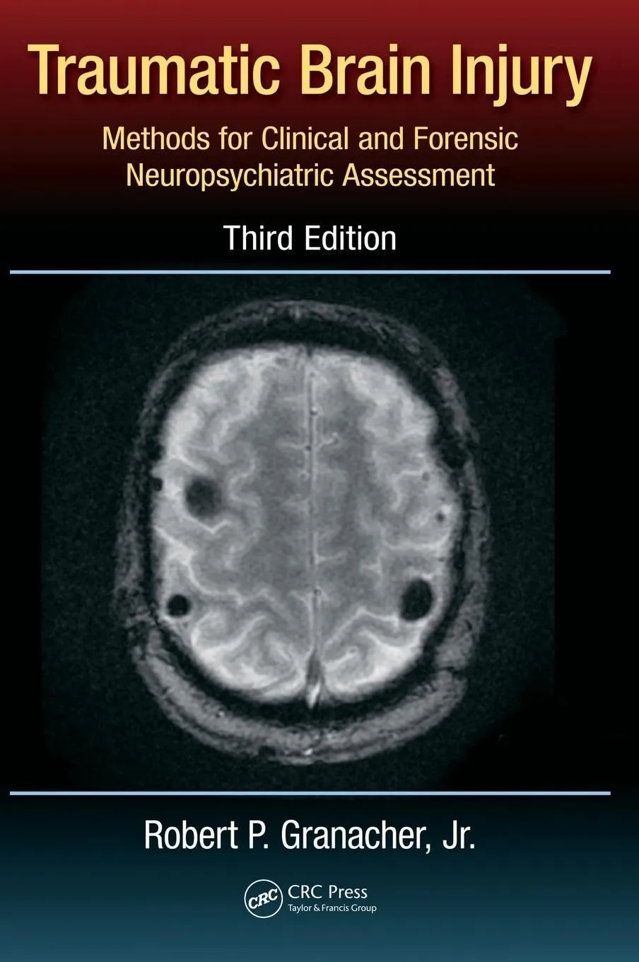 Traumatic Brain Injury | Third Edition | Hardcover