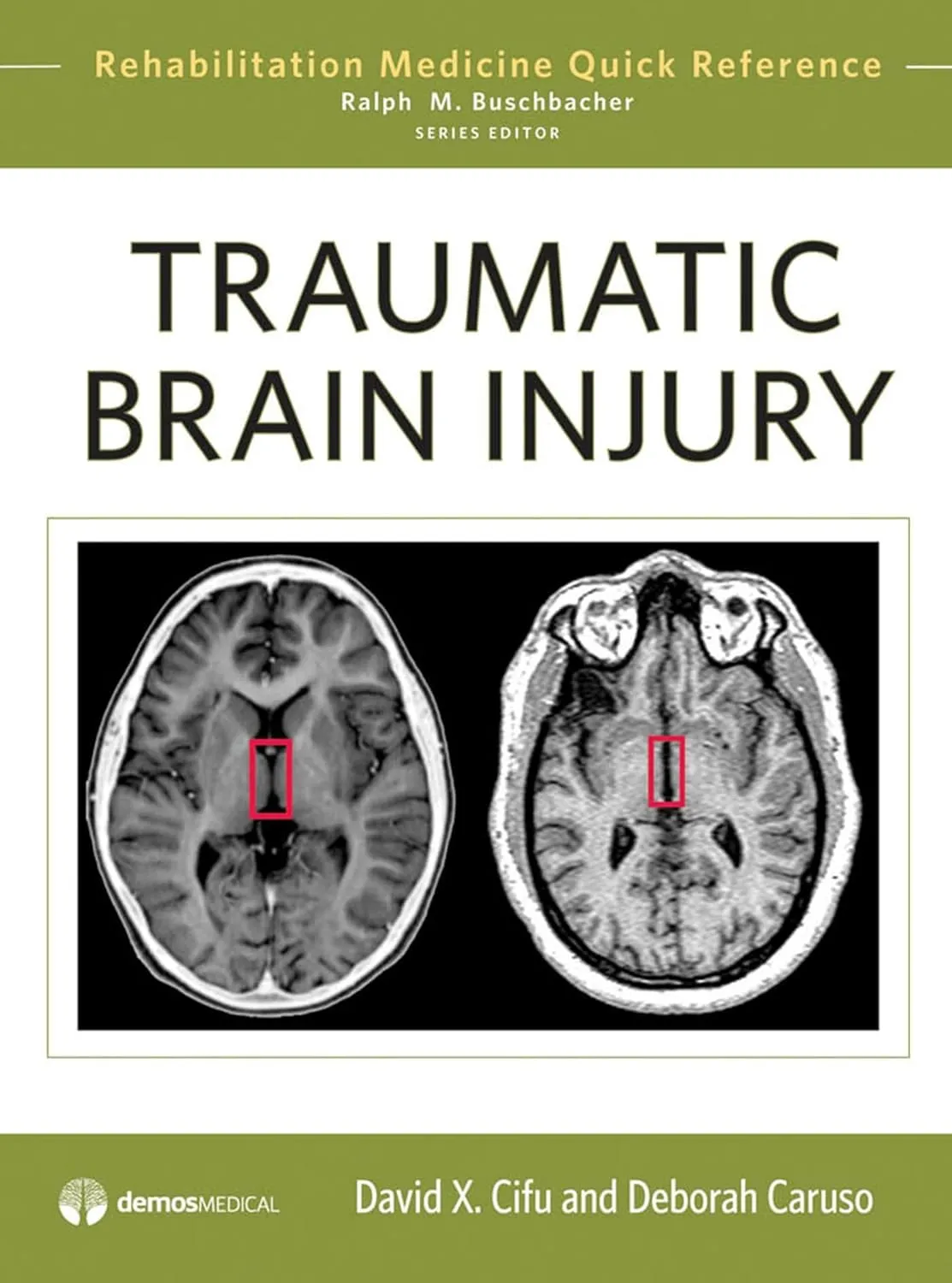 Traumatic Brain Injury Rehabiliation Medicine Quick Rference | Hardcover