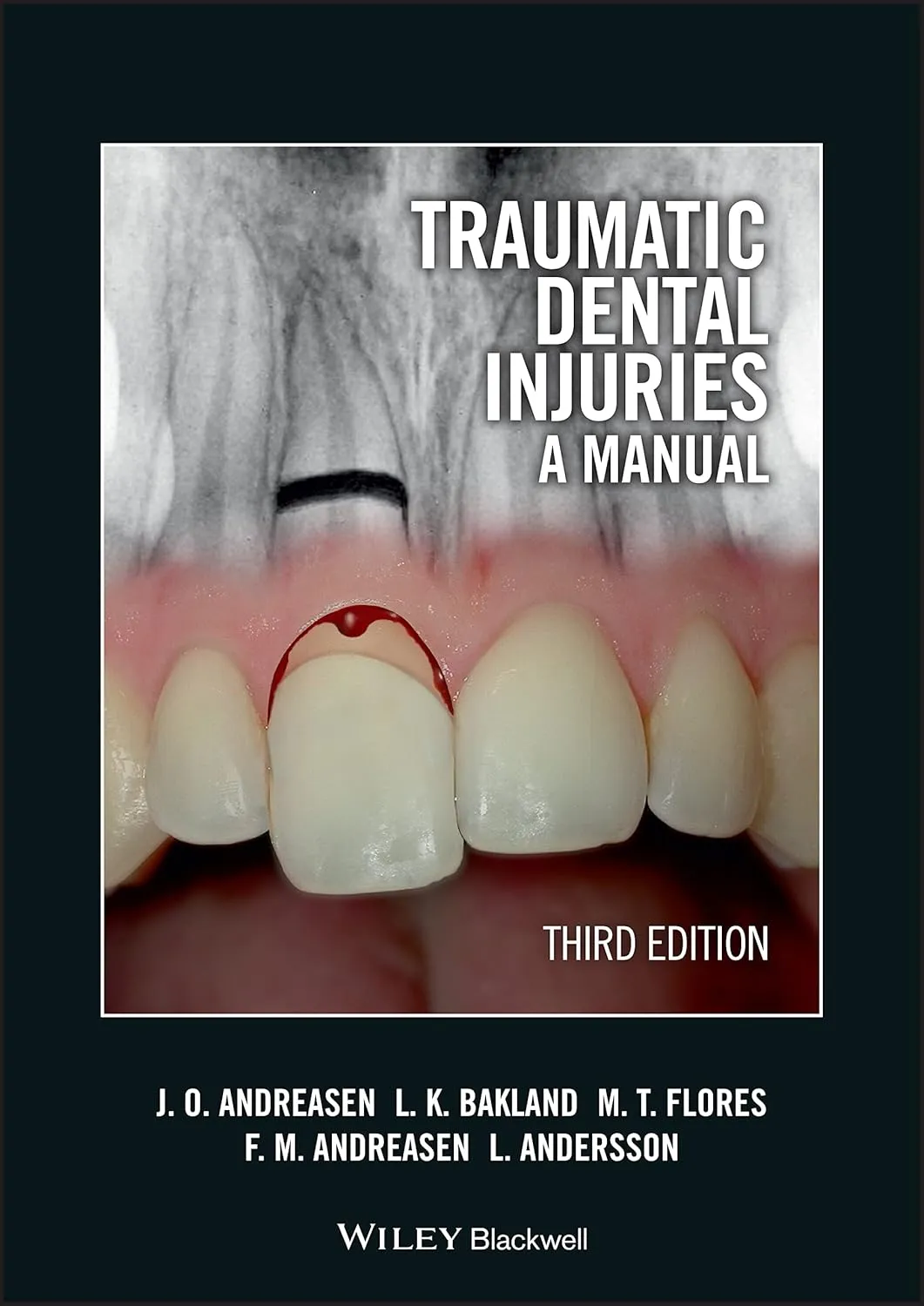 Traumatic Dental Injuries A Manual | Third Edition | With DVD | Paperback