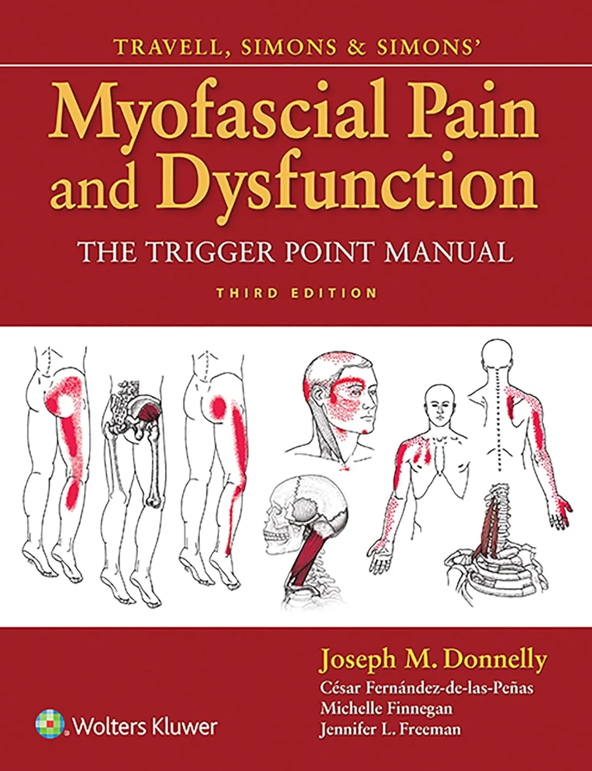 Travell | Simons and Simons' Myofascial Pain and Dysfunction The Trigger Point Manual | Third Edition | Hardcover