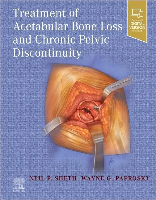 Treatment Of Acetabular Bone Loss And Chronic Pelvic Discontinuity With Access Code | Hardcover