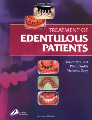Treatment of Edentulous Patients | Paperback