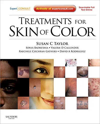 Treatments for Skin of Color | Hardcover