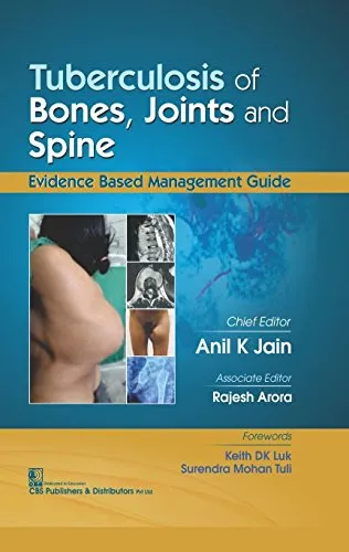 Tuberculosis of Bones Jounts and Spice | Hardcover