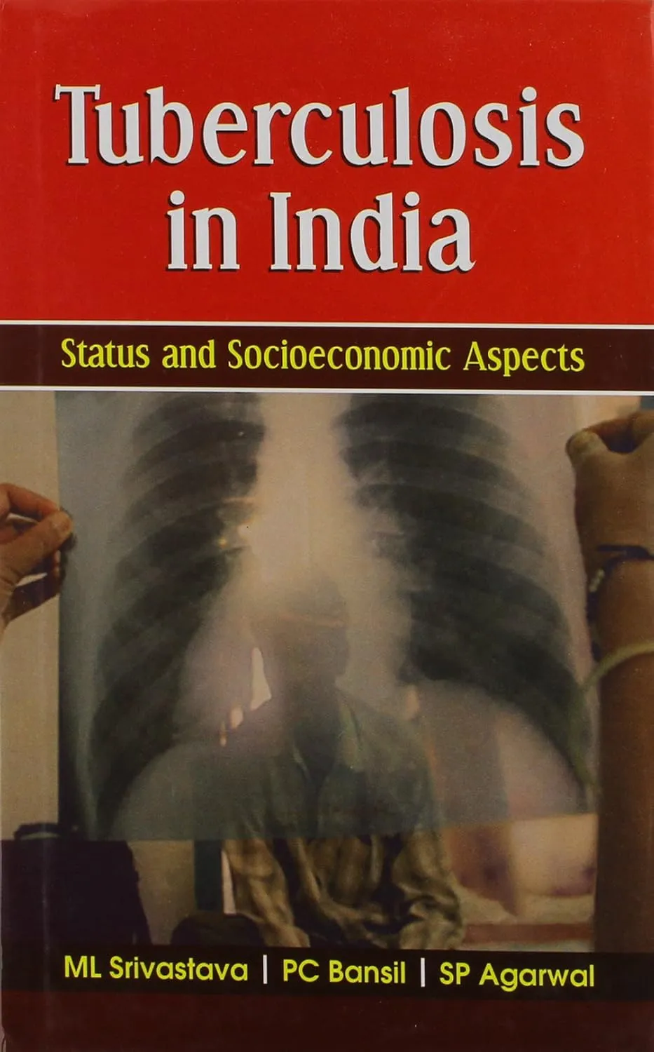 Tuberculosis in India Status and Socioeconomic Aspects | Hardcover