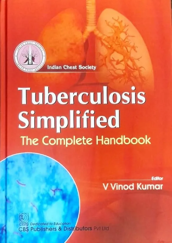 Tuberculosis Simplified The Complete Handbook | Hardcover