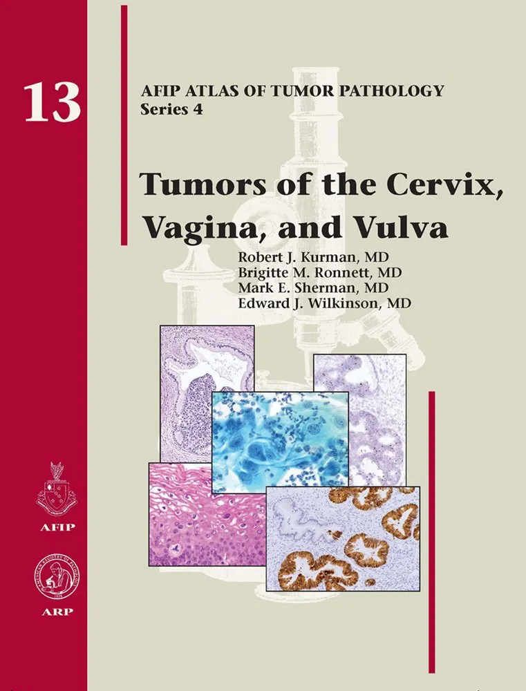 Tumors of the Cervix | Vagina | and Vulva 13 | Hardcover