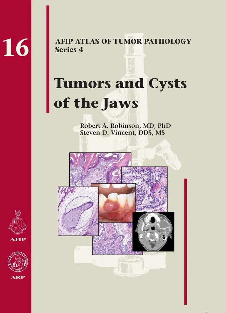 Tumors and Cysts of the Jaws 16 | Hardcover
