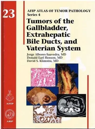 Tumors of the Gallbladder | Bile Ducts | and Vaterian System 23 | Hardcover