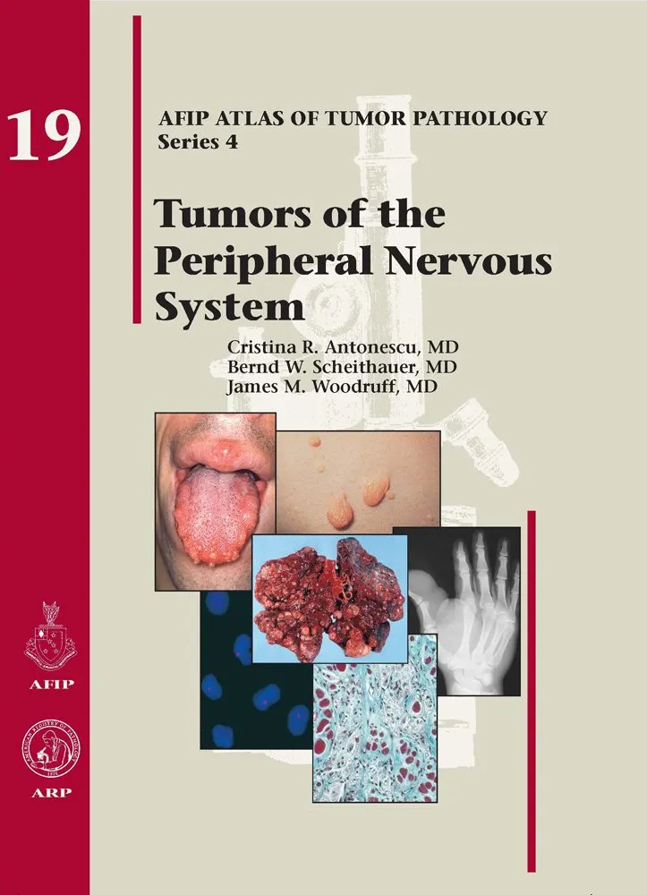 Tumors of the Peripheral Nervous System 19 | Hardcover
