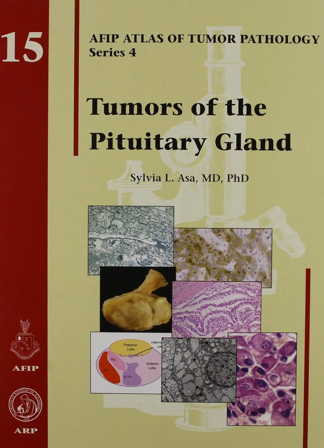 Tumors of the Pituitary Gland 15 | Hardcover