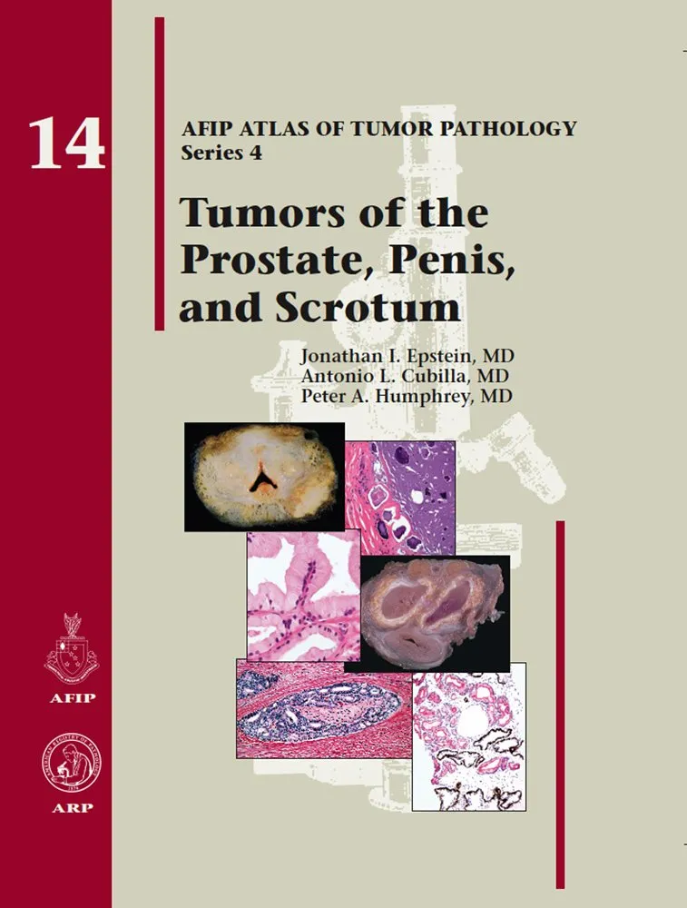 Tumors of the Prostate Gland | Seminal Vesicles | Penis and Scrotum 14 | Hardcover