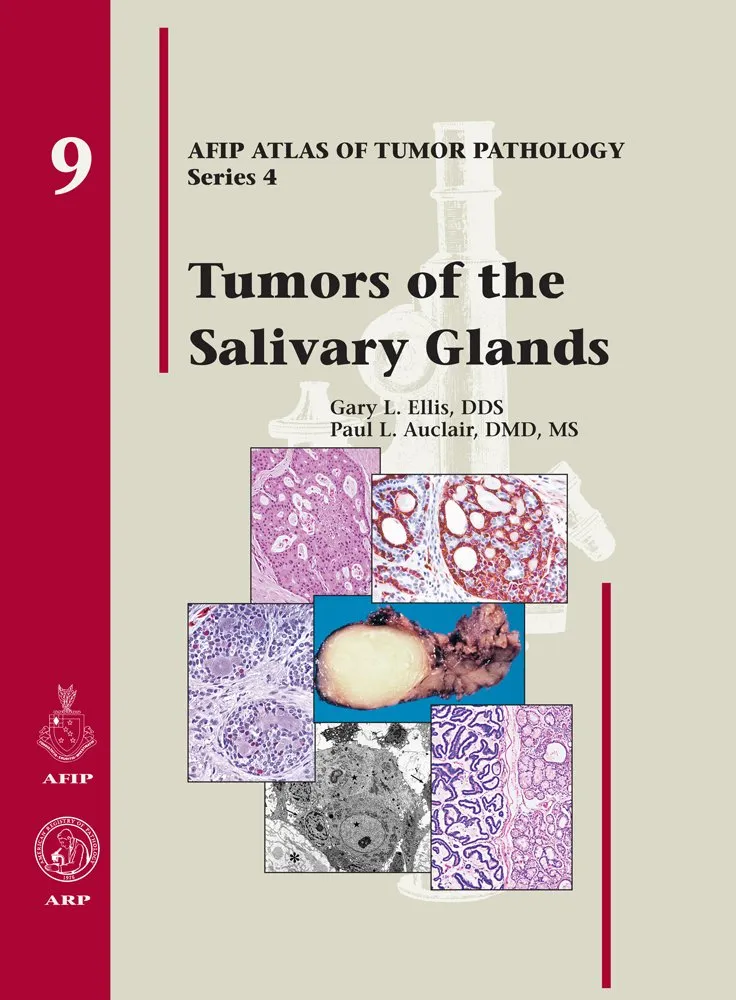 Tumors of the Salivary Glands | Series 9 | Hardcover