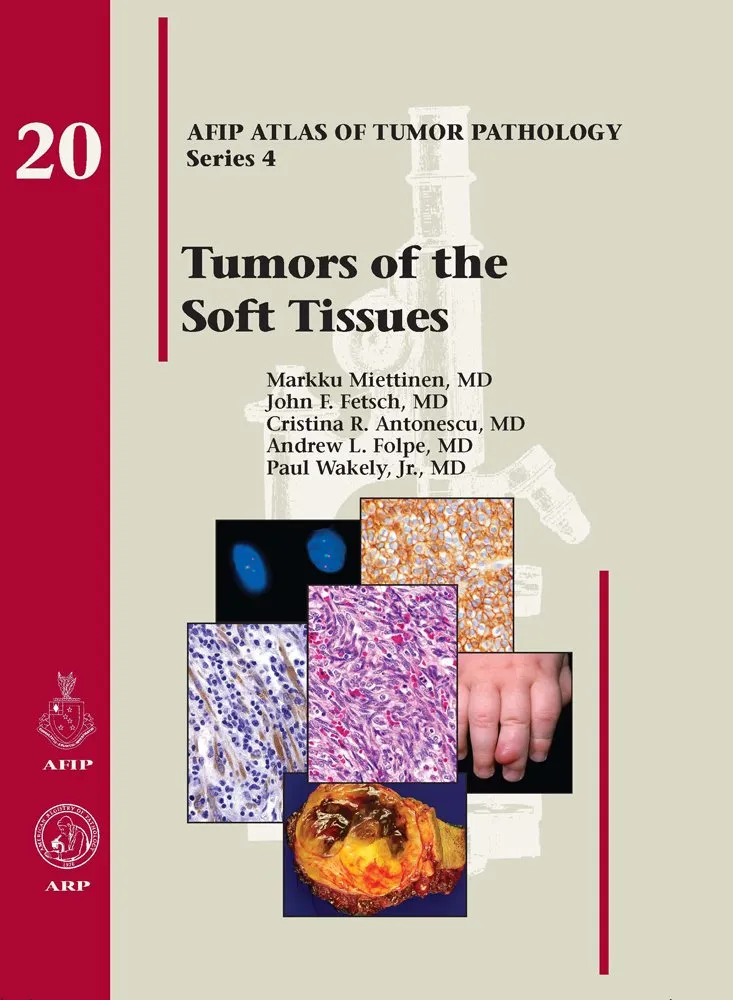 Tumors of the Soft Tissues 20 | Hardcover