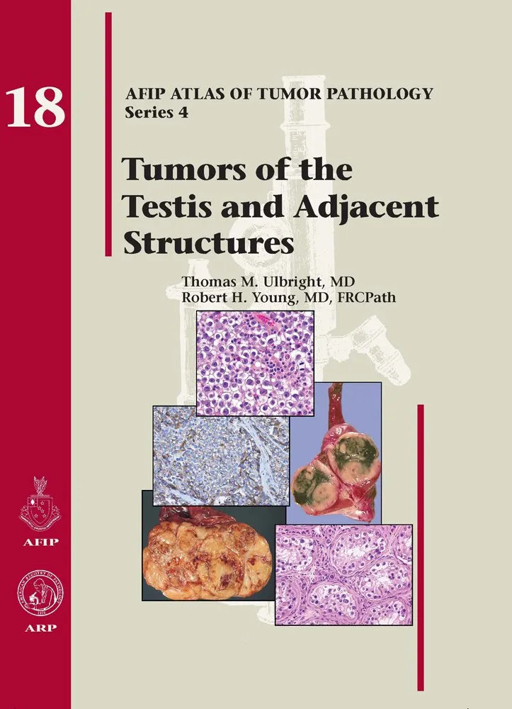 Tumors of the Testis and Adjacent Structures 18 | Hardcover