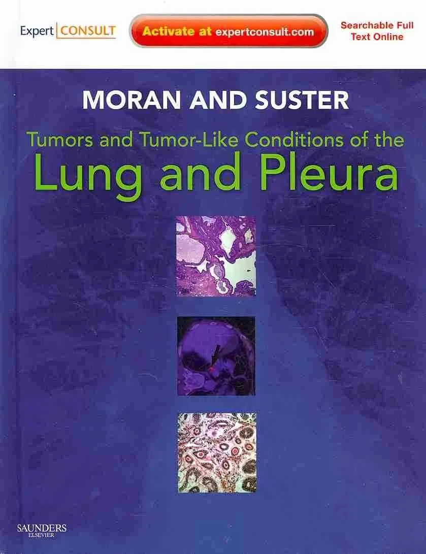 Tumors and Tumor-Like Conditions of the Lung and Pleura | Hardcover