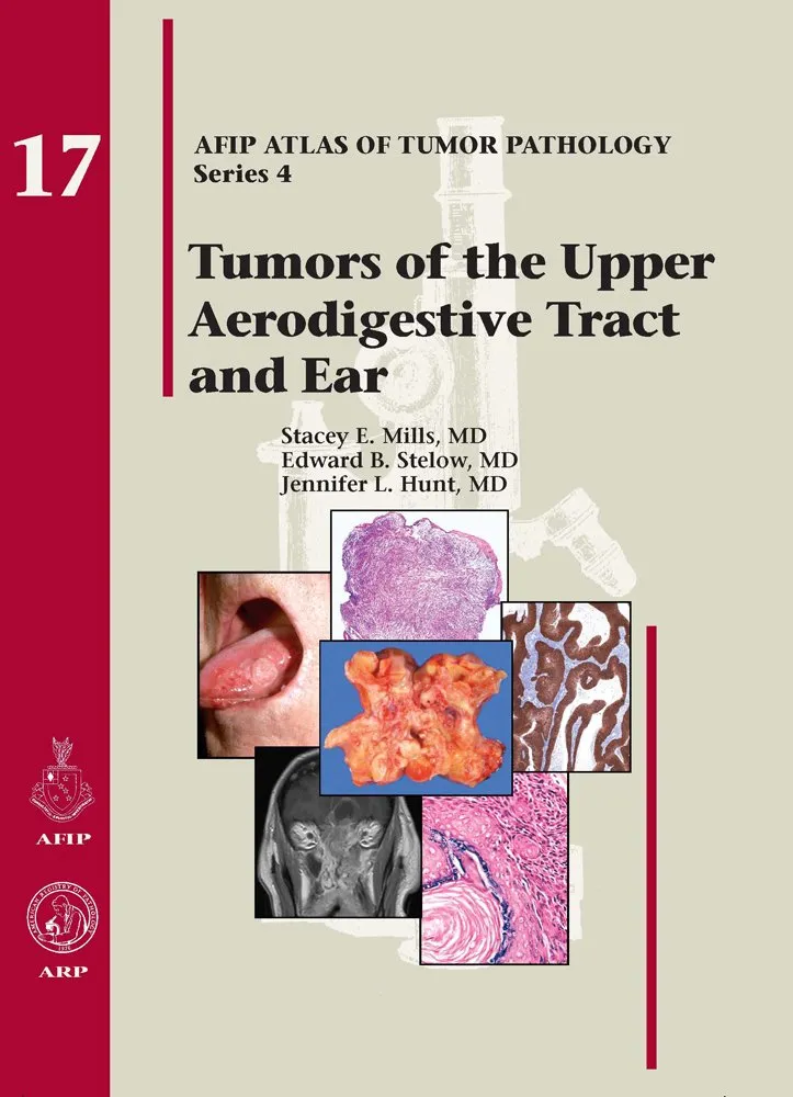 Tumors of the Upper Aerodigestive Tract and Ear 17 | Hardcover