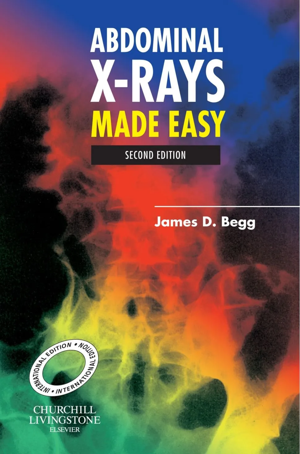 Abdominal X-Ray Made Easy(Int.Ed) | Paperback