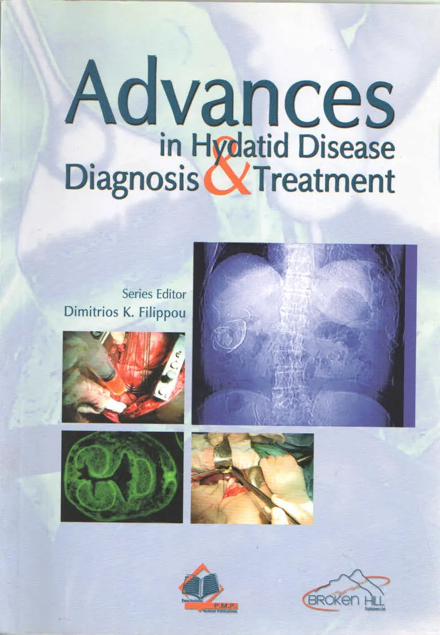 Advances In Hydatid Disease Diagnosis And Treatment | Paperback