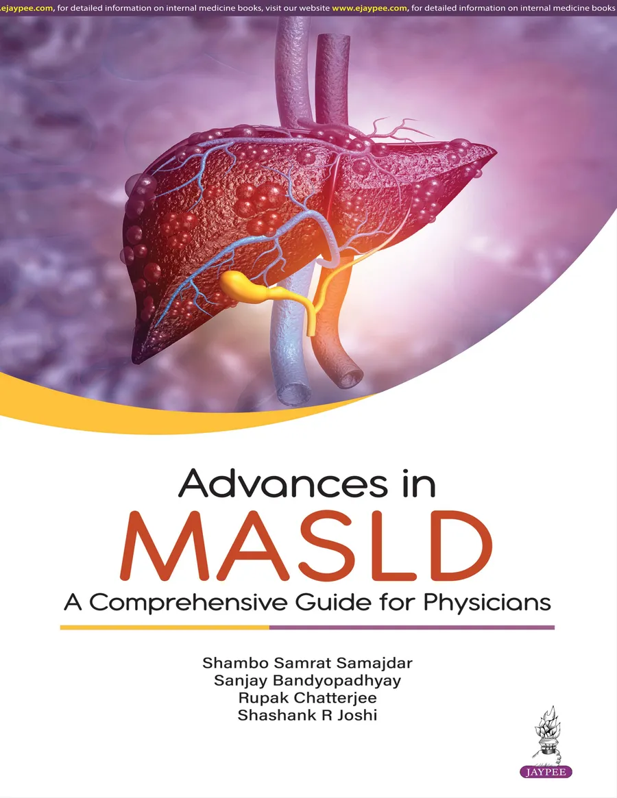 Advances In Masld : A Comprehensive Guide For Physicians | Paperback
