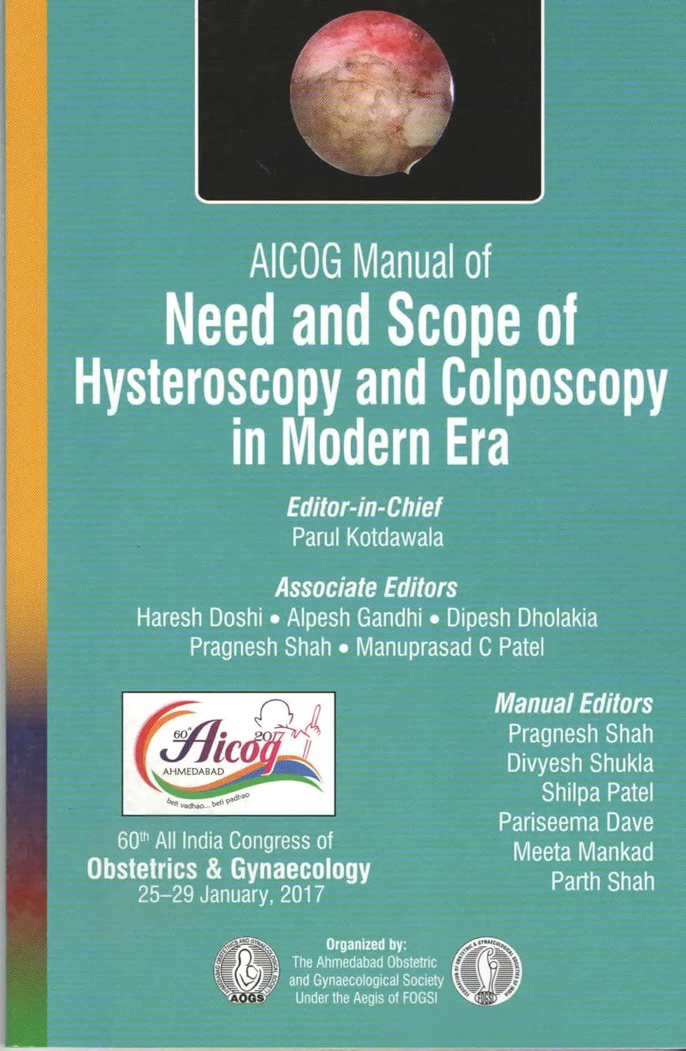 Aicog Manual Of Need And Scope Of Hysteroscopy And Colposcopy In Modern Era | Paperback