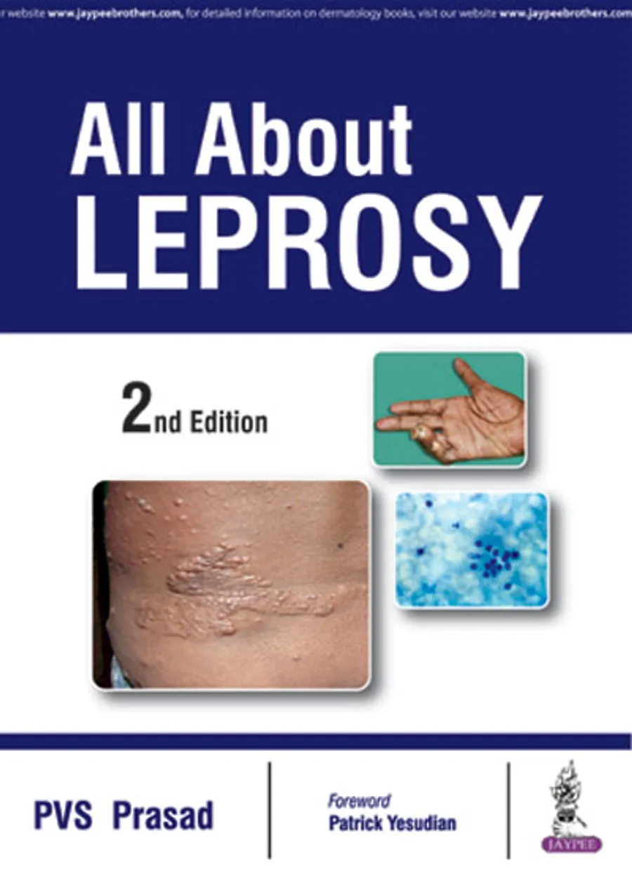 All About Leprosy | Paperback