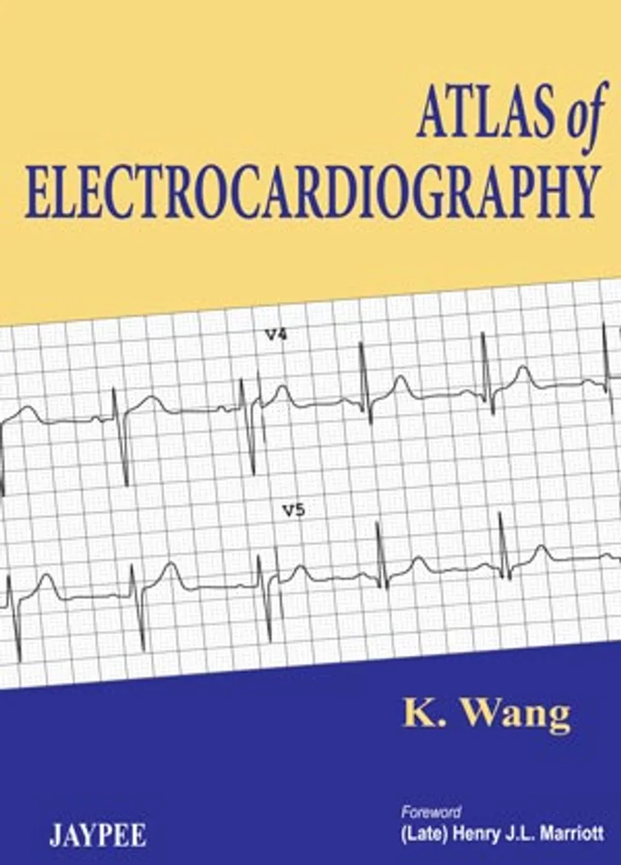 Atlas Of Electrocardiography | Paperback