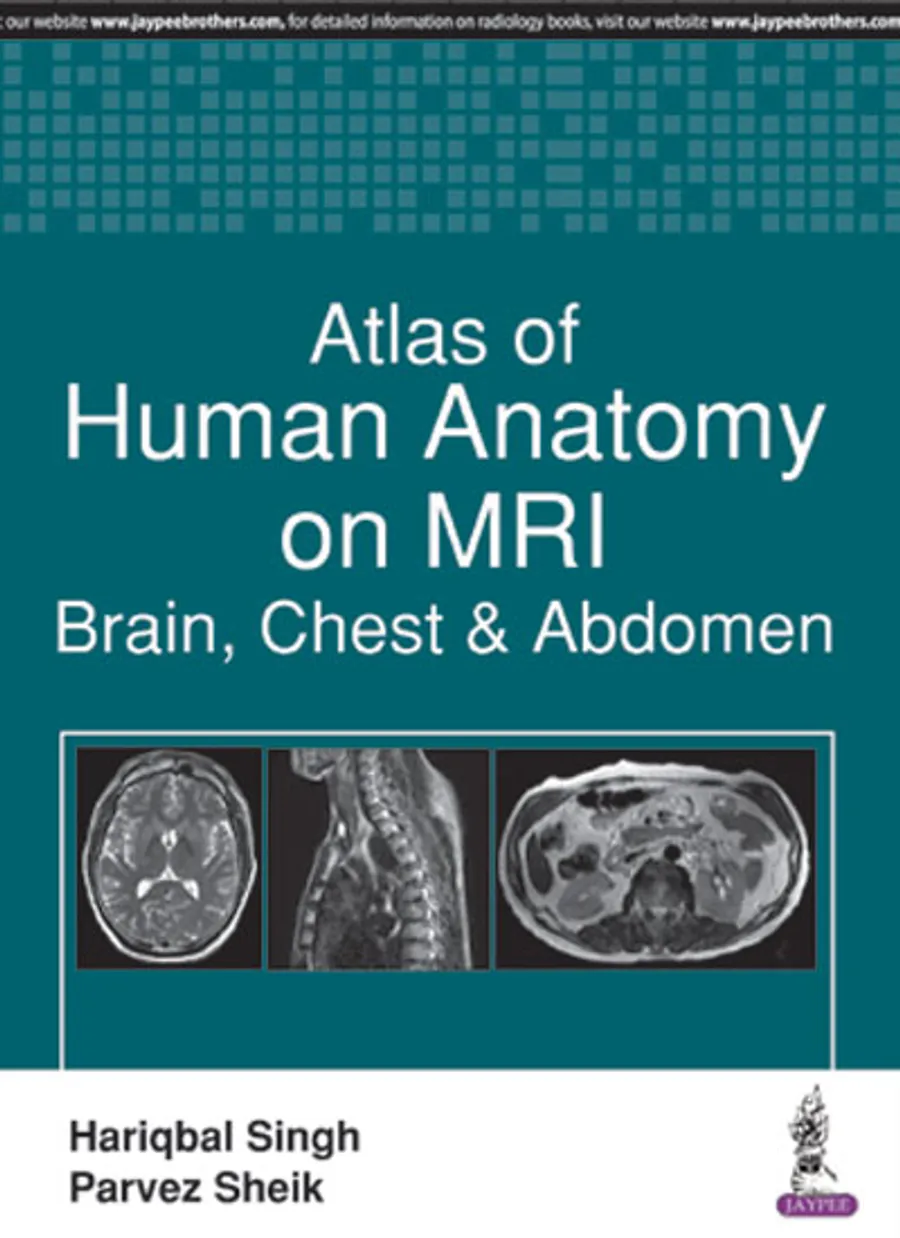Atlas Of Human Anatomy On Mri:Brain, Chest & Abdomen | Paperback