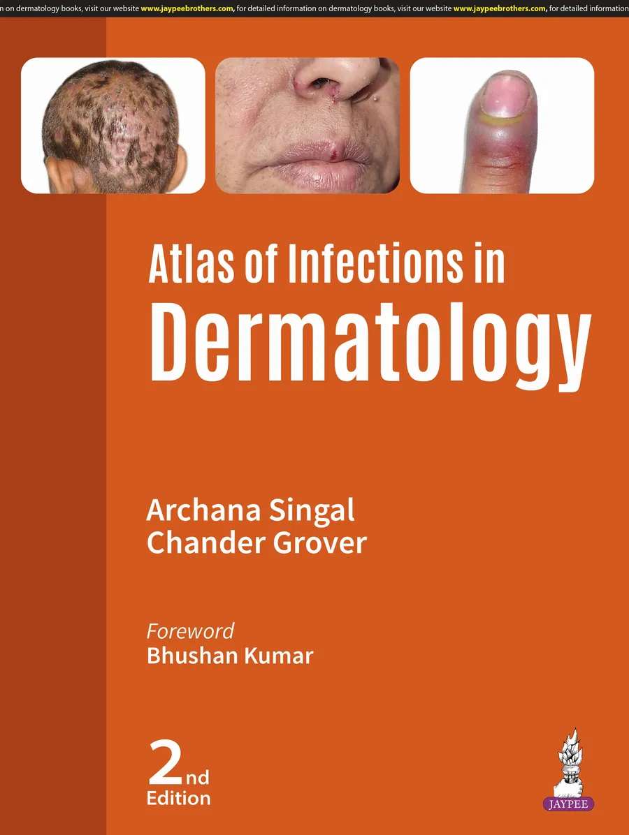 Atlas Of Infections In Dermatology | Hardcover