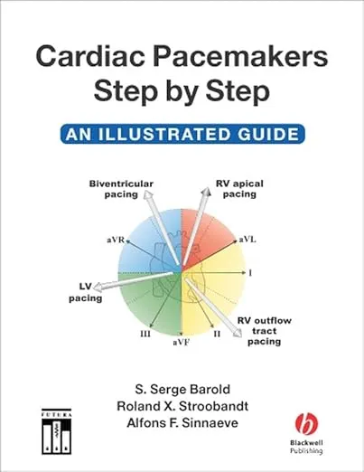 (Ex)Cardiac Pacemakers Step By Step An Illustrated Guide