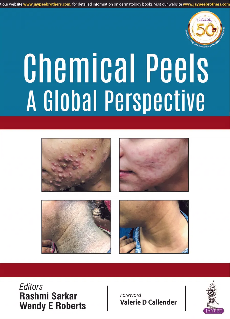 Chemical Peels: A Global Perspective | Paperback