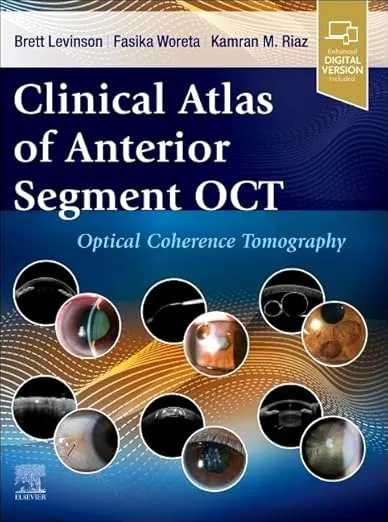 Clinical Atlas of Anterior Segment OCT: Optical Coherence Tomography -1st Edition