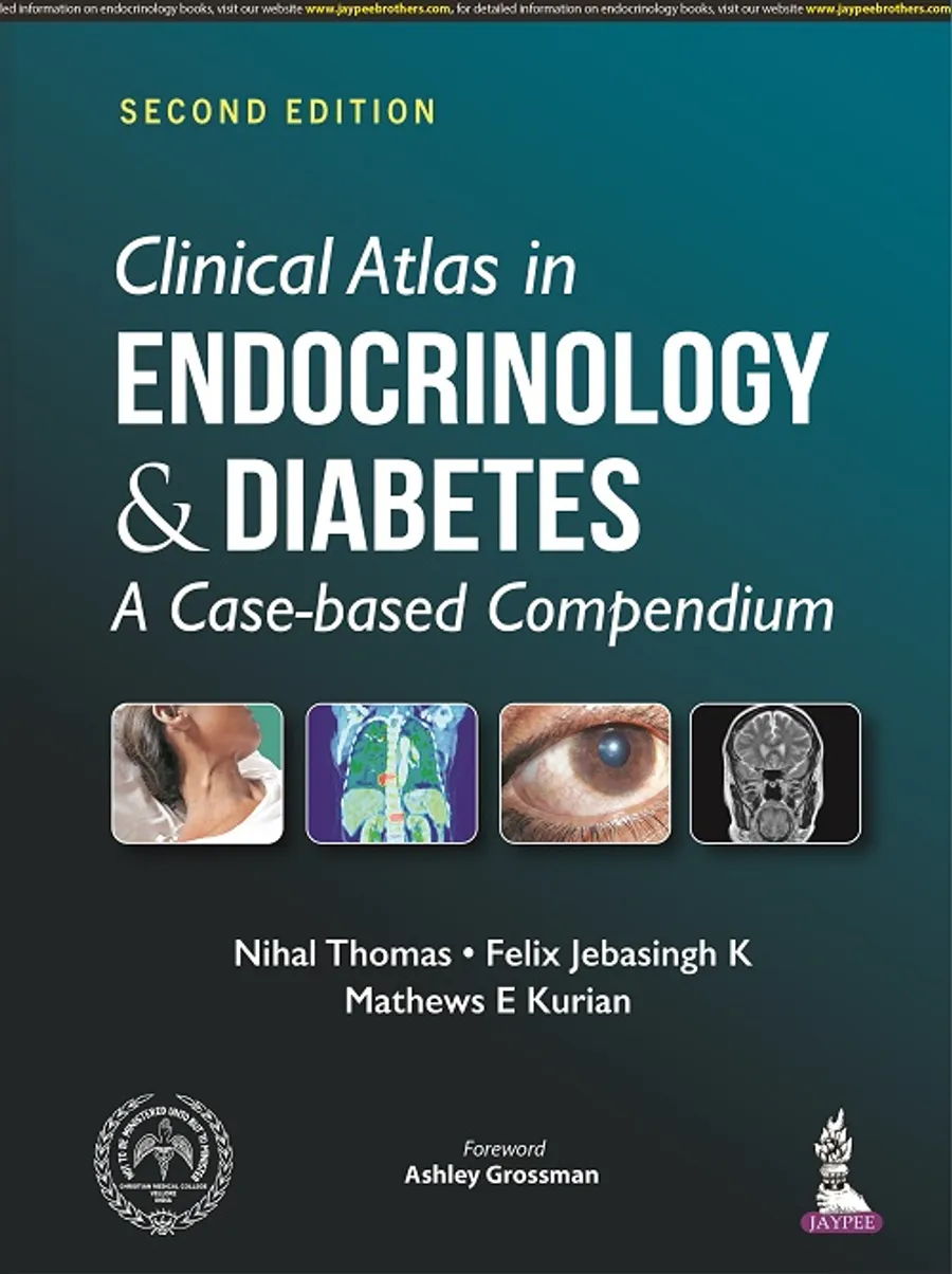 Clinical Atlas In Endocrinology & Diabetes: A Case-Based Compendium | Paperback