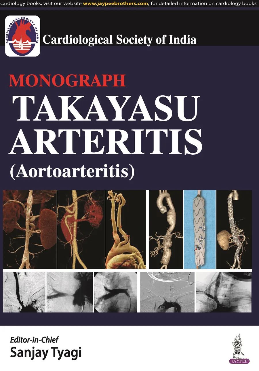Csi Monograph Takayasu Arteritis (Aortoarteritis) | Hardcover