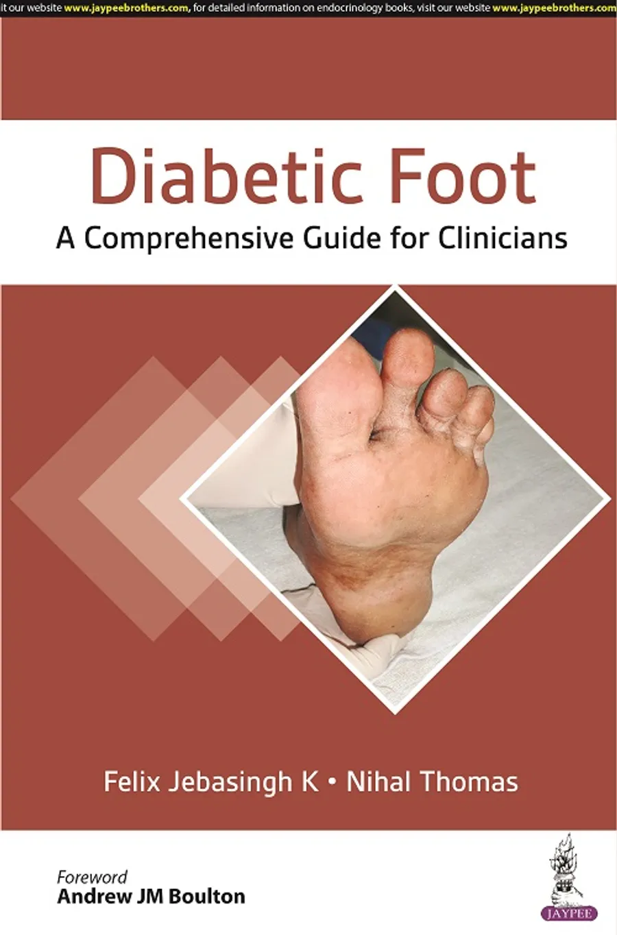 Diabetic Foot: A Comprehensive Guide For Clinicians | Paperback