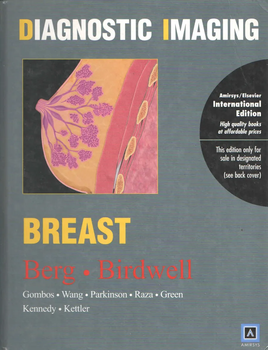 (Old)Diagnostic Imaging: Breast (Ie) | Hardcover